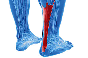 achilles tendon treatment in the Berks County, PA: Reading (Muhlenberg, Cumru, Wyomissing, Blandon, Shillington, Pennside, Birdsboro, West Reading, Sinking Spring, Laureldale, Reiffton, Fleetwood) areas