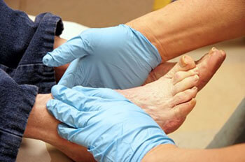 diabetic foot care in the Berks County, PA: Reading (Muhlenberg, Cumru, Wyomissing, Blandon, Shillington, Pennside, Birdsboro, West Reading, Sinking Spring, Laureldale, Reiffton, Fleetwood) and Philadelphia, PA areas