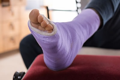 foot and ankle fractures treatment in the Berks County, PA: Reading (Muhlenberg, Cumru, Wyomissing, Blandon, Shillington, Pennside, Birdsboro, West Reading, Sinking Spring, Laureldale, Reiffton, Fleetwood) areas